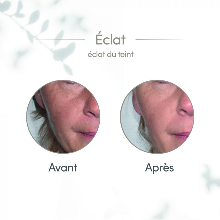 GLYCONIGHT 10% MASQUE